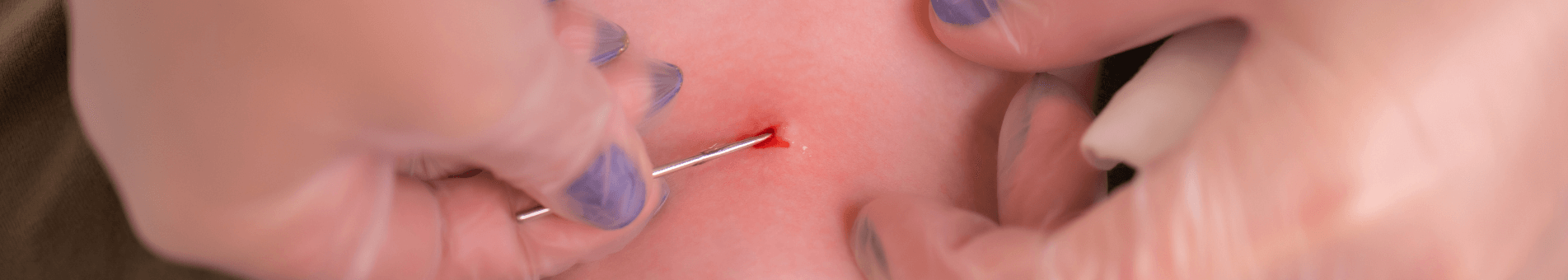 Das Korsett Piercing